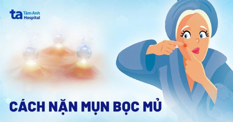 Cách Trị Mụn Bọc Sưng Đỏ Hiệu Quả An Toàn Tại Nhà Và Khi Nào Cần Bác Sĩ